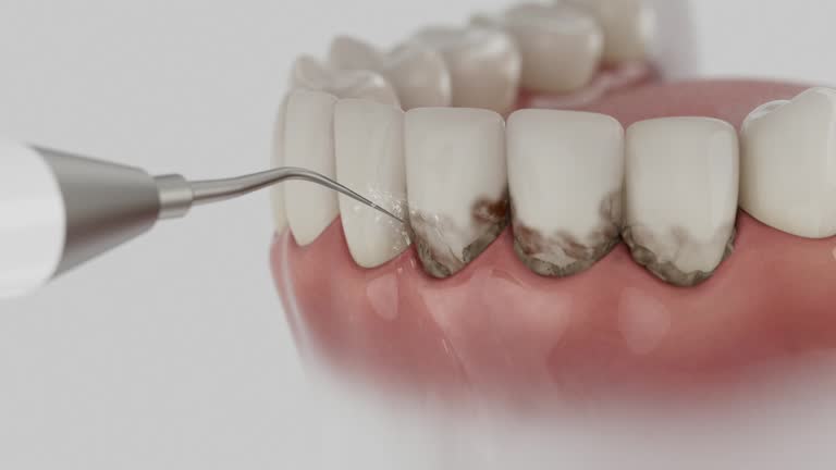 Trusted Emergency Dentist service in Vancleave, MS - Dentist Open Now